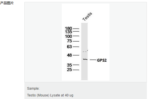 605c434d8be78.png image.png